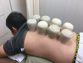 平井鍼灸整骨院 吸い玉(カッピング)のメニュー画像