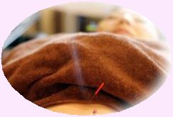 【美容鍼/妊活/女性専門】はり灸治療院ねこの手 妊活鍼灸治療コースのメニュー画像