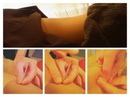 さんぽ整骨　鍼灸　マッサージ院 オーダーメイド治療のメニュー画像