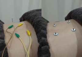 HIRO鍼灸治療院 鍼灸治療 (肩こり、腰痛、神経痛)のメニュー画像