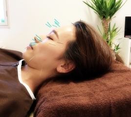 JIN鍼灸整骨院 Beautyコースのメニュー画像
