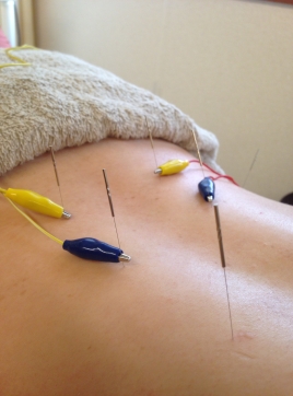 ケイトリート鍼灸マッサージ院 鍼灸マッサージ(全身治療)のメニュー画像