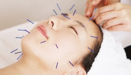 本山さくら鍼灸サロン 初回限定　スタンダード　美容鍼　のメニュー画像