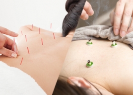 本山さくら鍼灸サロン 初回　スタンダード　はり灸のメニュー画像