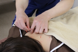 しんわはりきゅう接骨院 鍼灸施術のメニュー画像