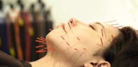 ワカサ鍼灸サロン 美容鍼(小顔矯正含む)のメニュー画像