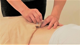 POYL整骨院 鍼灸治療のメニュー画像