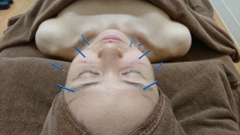 ほんあつ治療院 フェイシャルコースのメニュー画像