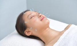 アサンキヤはりきゅう院 お顔の美容鍼灸50本コースのメニュー画像