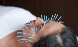 アサンキヤはりきゅう院 お顏の美容鍼灸100本コースのメニュー画像