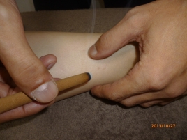 村上はりきゅう治療室 逆子 安産のメニュー画像