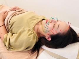 POYL整骨院 美容鍼のメニュー画像