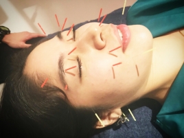 鍼灸院Harista31 ハリウッドスタイル上田式美容鍼灸®のメニュー画像