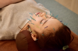 鍼灸治療院OHALO 美容鍼（贅沢コース）のメニュー画像