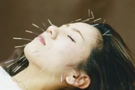 笹岡尚幸鍼灸院 電気を流す美容鍼　２ヶ月目以降　　のメニュー画像