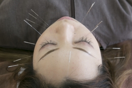 おち鍼灸治療院 経絡手技療法・美容鍼のメニュー画像