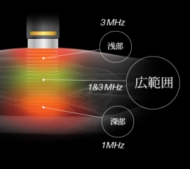 アイリス茨木整骨院 超音波治療のメニュー画像