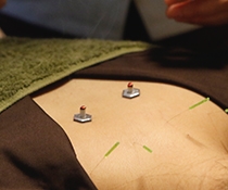 鍼灸あのん和療院 鍼灸＆整体のメニュー画像