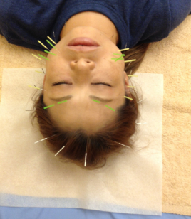 そら鍼灸院 オリジナル【活法・温灸ダイエット】のメニュー画像