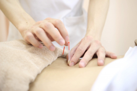 清澄駅前鍼灸整骨院 ASTA-鍼療法のメニュー画像