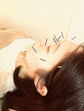 メニュー写真