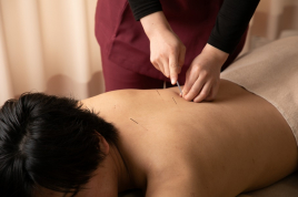 八王子北口整骨院  鍼治療（全身）のメニュー画像