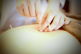 蓮鍼灸院 Superlative　鍼灸コースのメニュー画像