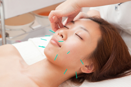 MSはり・きゅう 美容鍼灸のメニュー画像