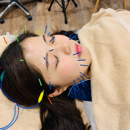 ichigayaの鍼灸整骨院 『お顔に特化した』美顔鍼ゴールドコースのメニュー画像