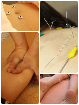 名駅せんが鍼灸院 全身調整鍼灸治療のメニュー画像