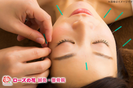 ローズの花鍼灸整骨院　コモディイイダ豊春店 美容鍼+炭酸パックコースのメニュー画像