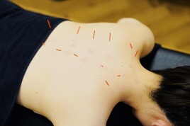 笑顔道　スイッチオン整骨院 全身調整コースのメニュー画像