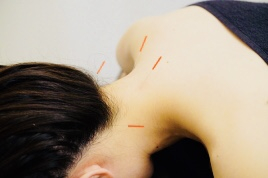 笑顔道　スイッチオン整骨院 痛み改善コースのメニュー画像