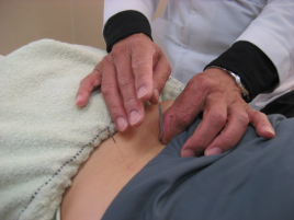 堀江鍼灸治療院 プラチナ鍼灸・整体療法のメニュー画像