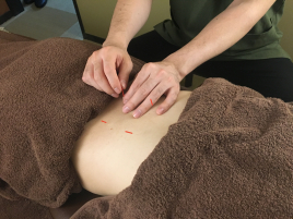 神田はりきゅう整骨院 楚々 鍼施術のメニュー画像