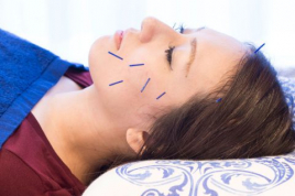 桜整骨・鍼灸院　黒門店 美容鍼　百華のメニュー画像