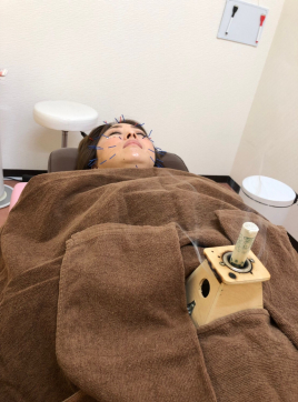 和（あい）はり・きゅう治療院 美容鍼灸+ボディメンテナンスのメニュー画像