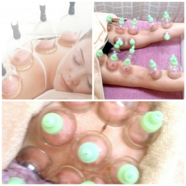 はり灸Relaマオン デトックスカッピング（吸い玉）　のメニュー画像