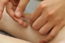 いころ鍼灸院 鍼治療+関節可動域調整(中学生〜学生)のメニュー画像