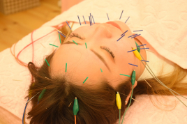 野の花鍼灸院 電気を流す美容鍼　のメニュー画像