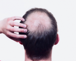 鍼灸サロンＡＫＡＲＩ〜育毛　美胸･美尻   男勢力〜 育毛・発毛 (3部位)のメニュー画像