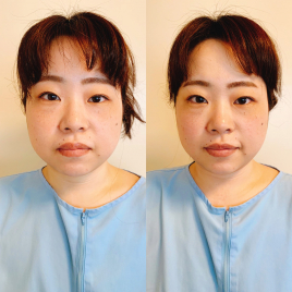安眠道鍼療院 自律神経美容鍼・美顔鍼のメニュー画像