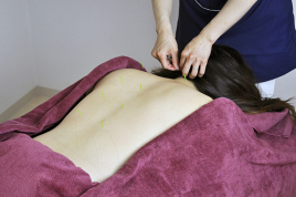 鍼灸サロン　PAL 鍼灸治療90分コースのメニュー画像