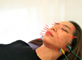 しおやき鍼灸整骨院 電気美容鍼コースのメニュー画像