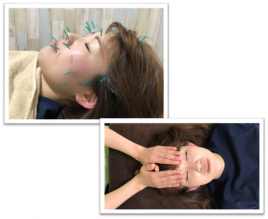 かげん鍼灸院・整体院 美容鍼コース＋頭蓋骨療法コースのメニュー画像