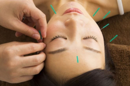 プラース鍼灸治療院 きれいをつくる　美容鍼のメニュー画像