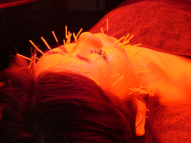 香り鍼灸院NONO ４０歳からの肌再生プログラムのメニュー画像