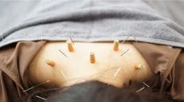 鍼灸整体院ひら山 鍼灸のメニュー画像