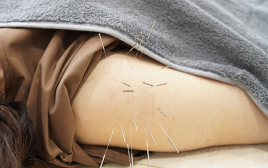 鍼灸整体院ひら山 五十肩治療のメニュー画像