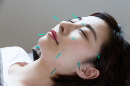 まつもと鍼灸整骨院 美容鍼のメニュー画像